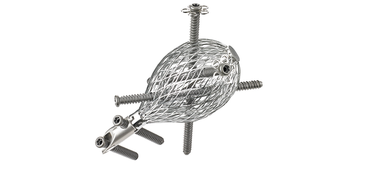 Conventus Milestone: Over 700 Patients With Expandable Cage