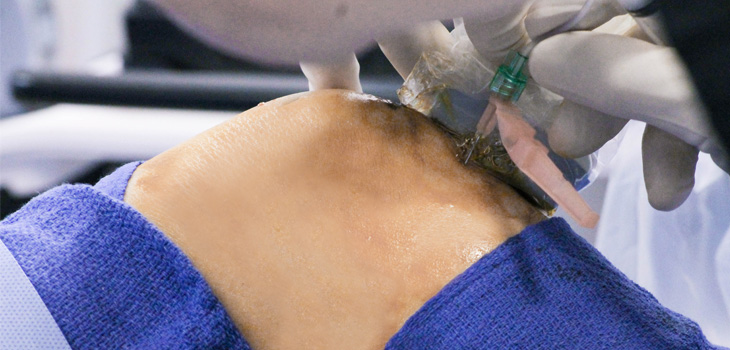 Updated MSC and PRP Research Highlight February IOF Conference