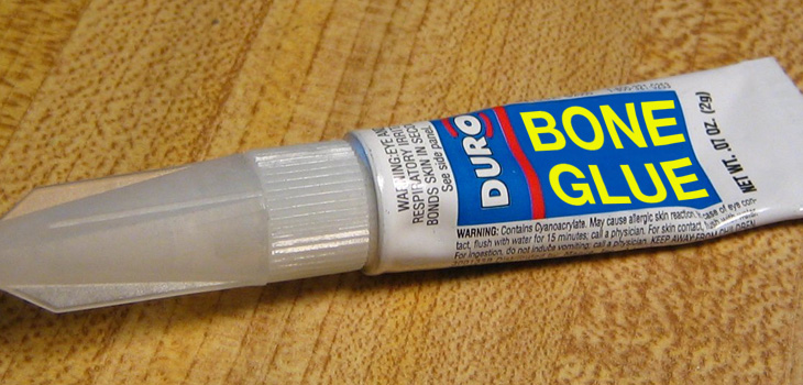 Bone Glue Market: $1, 032.9 Million by 2024