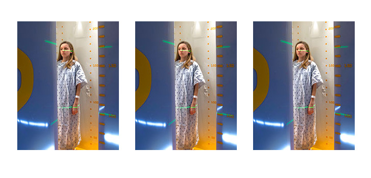 EOS imaging: First Site in South Korea