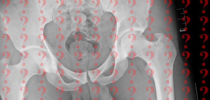 Where Does That Back Pain Really Come From?