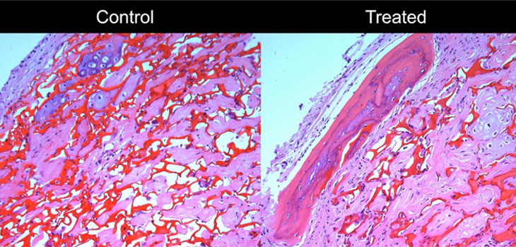 Bone Marrow Proteins Regulate Bone-Building Cells