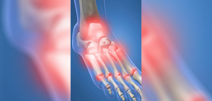 New Study: CoolPulse Technology Reduces Foot Injection Pain