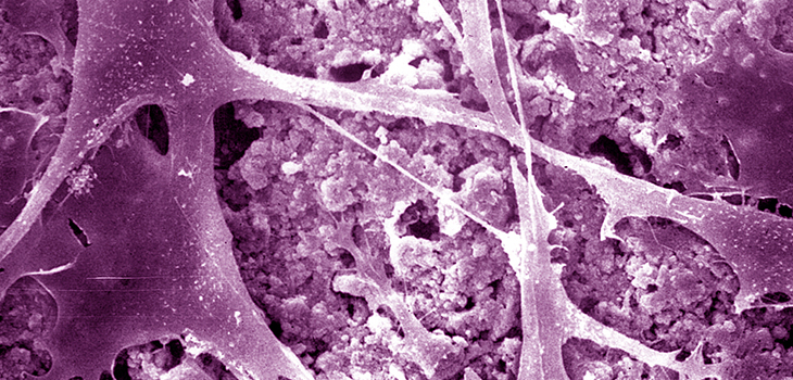 3D Printed Stem Cells Grow Bone