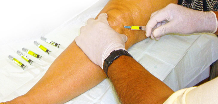 Zimmer Biomet’s Gel-One Effective for 26 Weeks