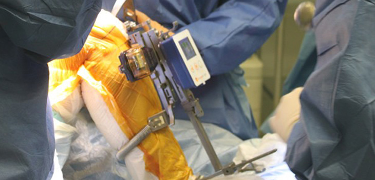 OrthAlign & Analog Devices Jointly Develop Surgical Sensor