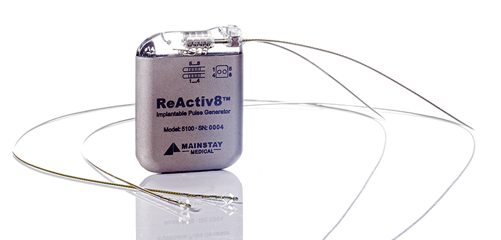 Mainstay Medical: First Sale of ReActiv8 in Germany