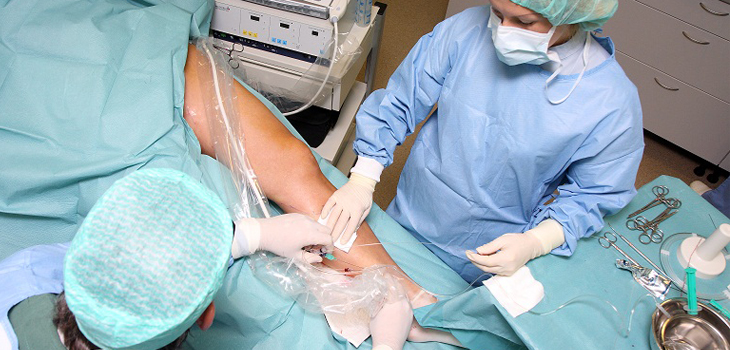 New Study: RSA Improves Meniscal Transplant Matching