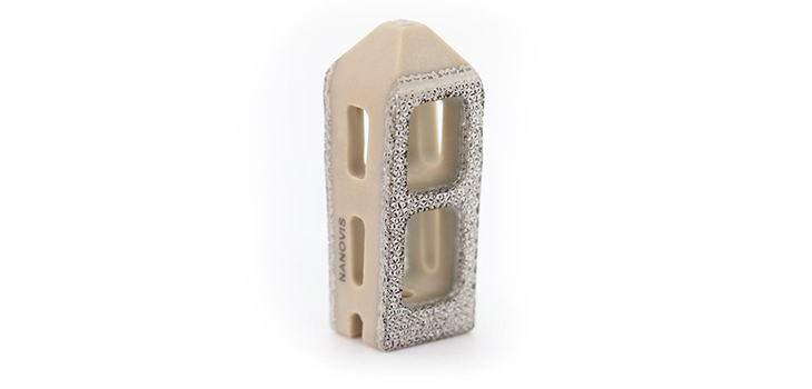Nanovis: Launch of the FortiCore PLI, 2,000th FortiCore Implantation