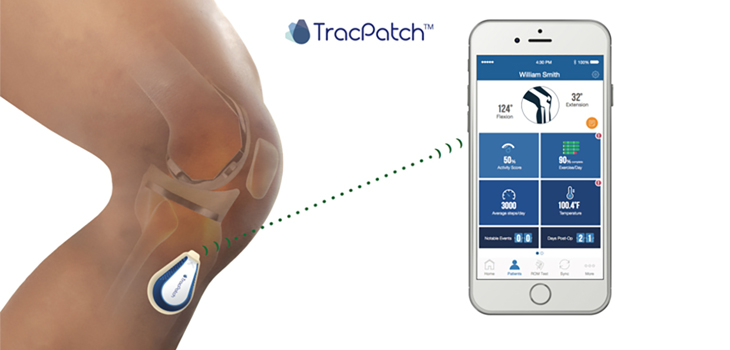 New Electronic Device Monitors Patient Compliance