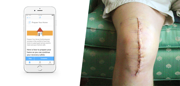 Schoen Klinik Partners With PeerWell for Prehab