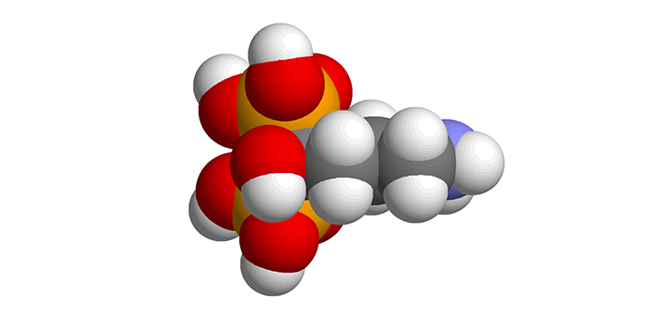 Bisphosphonates Leading to Microcracks?