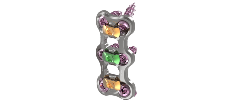 Altus Spine: FDA Clearance for Fuji Cervical Plate System