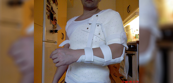 Positive Results With both Arthroscopic and Open Tenodesis