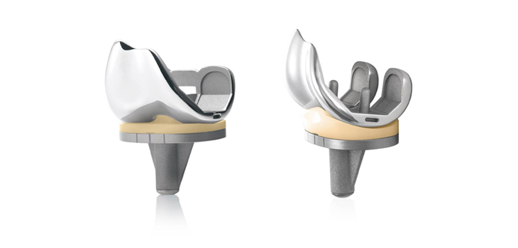 Taiwanese Poly Knee Insert Cleared for U.S.