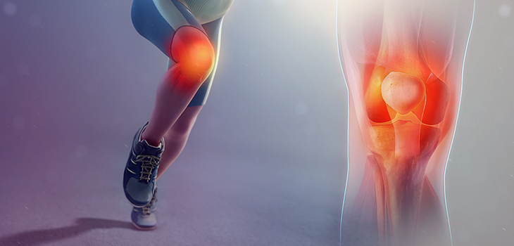 HYAJOINT Plus Trumps Synvisc-One on Pain, Stiffness