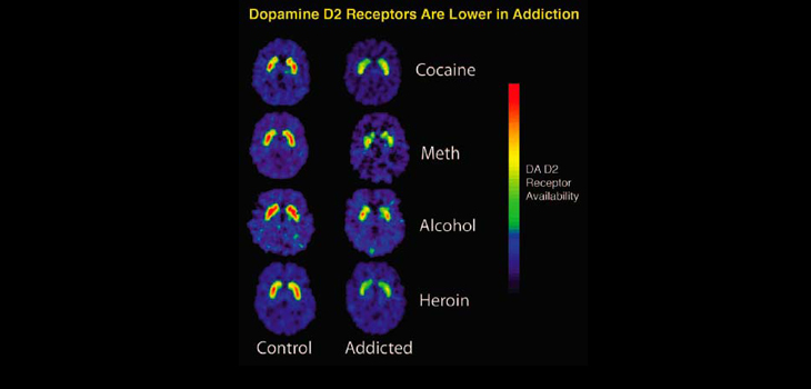 Pennsylvania’s Opioid Guidelines Have National Ortho Impact