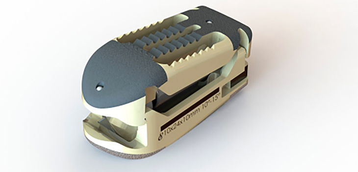 Spinal Elements: First Procedures With Lucent Interbody Implant