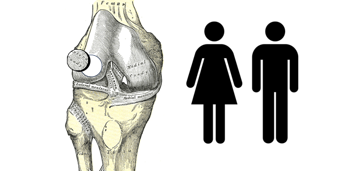Osteochondral Allograft Transplantation: Do Age and Sex Matter?
