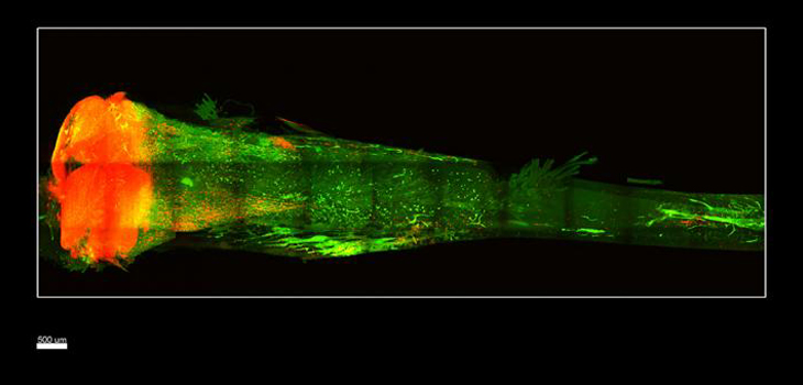 Transparent Bones!; New Biomechanics Testing Approach; IV Acetaminophen vs. Opioid
