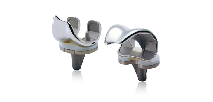 Taiwan Based UOC: First in Man for Knee System