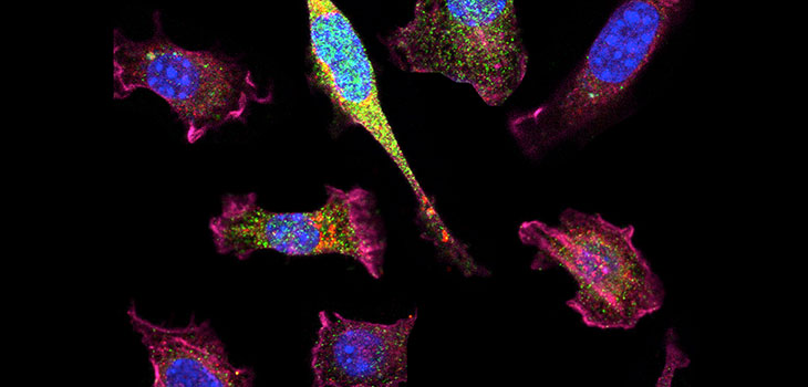 Rewired Stem Cells=Arthritis Vaccine