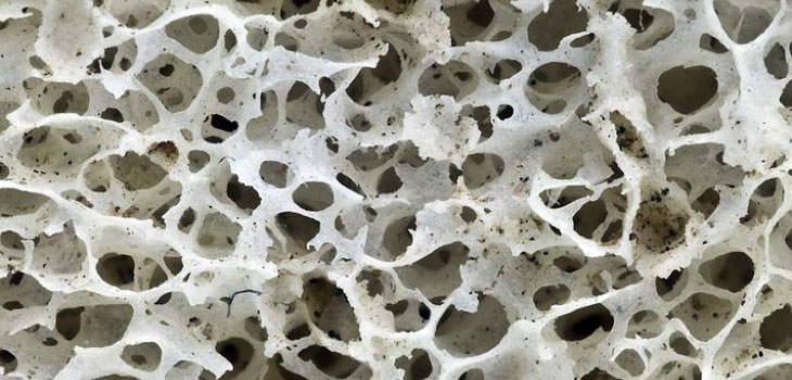 New Bone Tech From TheraCell