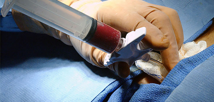 Artificial Bone Tissue Could Produce Marrow