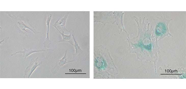 Old Cells: Get Them Out and Stop OA
