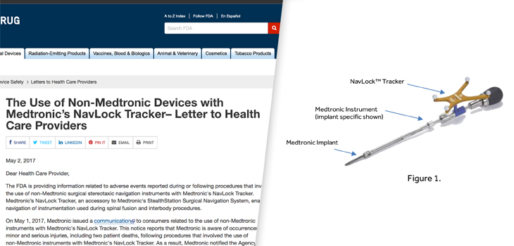 Deaths Spur Relabeling of Medtronic Spinal Navigation System
