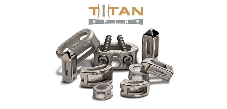 Titan Spine: Record Sales and 1,000 Endoskeleton Implantations