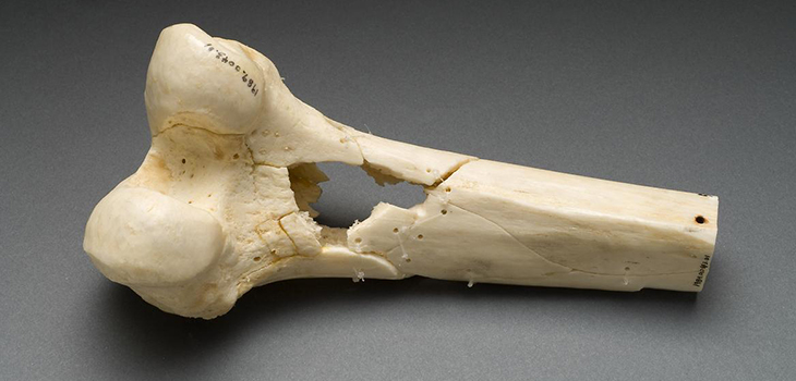 $2.2 Million Grant to Study Bone Injuries