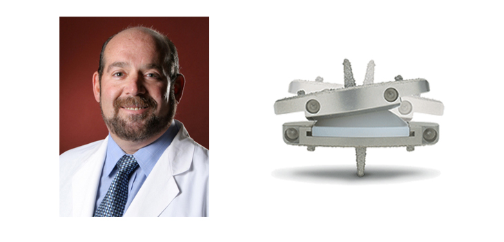 Hanging Tough: Lumbar Disc Replacement Over Fusion