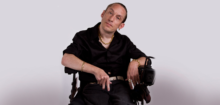 New Mayo Study: TKA in Patients with Cerebral Palsy