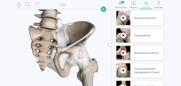 Faster Ortho Consultation in a Novel New APP