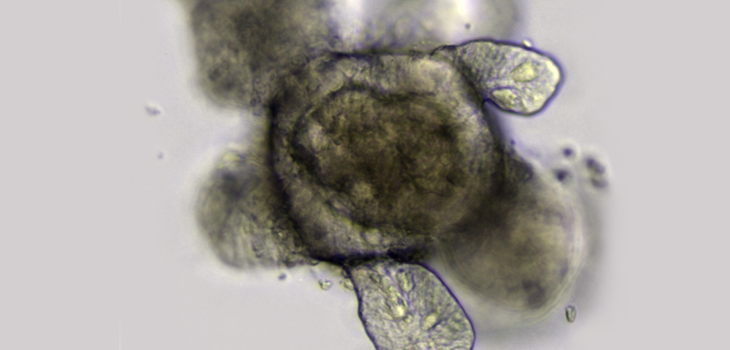 Organoids Set to Dominate Stem Cell Therapy