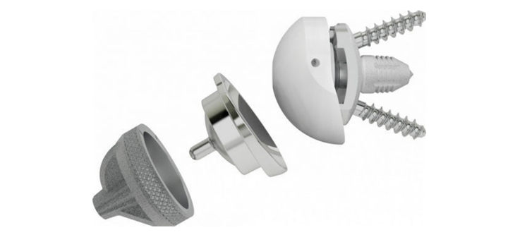 New Personalized Shoulder Instruments From Lima