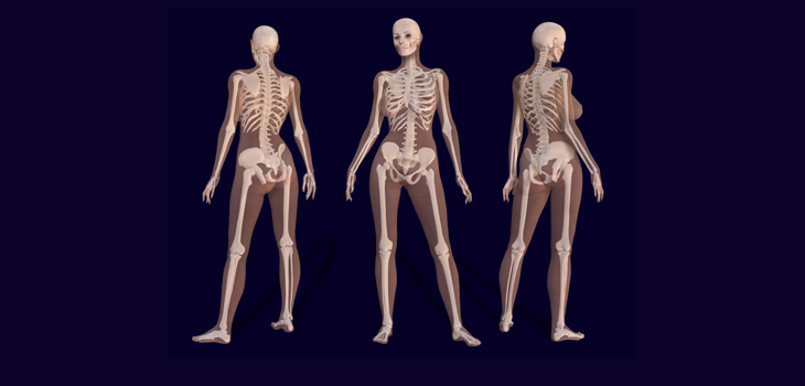 Higher BMI Helps Heal Stress Fractures