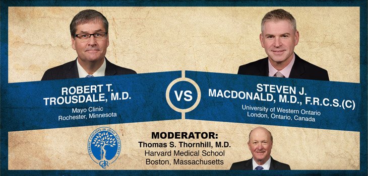 Trousdale v. MacDonald: The Cemented All Poly Tibia in the Active <60 Patient
