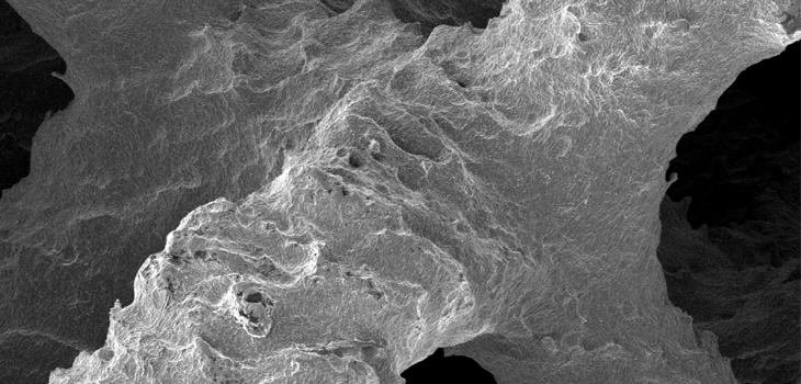 FDA Clears Novel German ALIF, PLIF and TLIF Implants