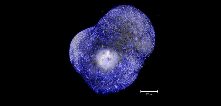 Andrews Institute & Kuala Lumpur Center Partner in Stem Cell Study
