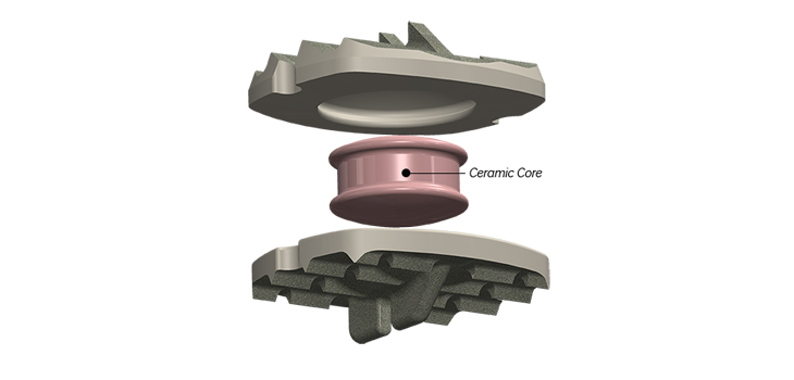 Simplify Medical Submits PMA Application for Simplify Disc