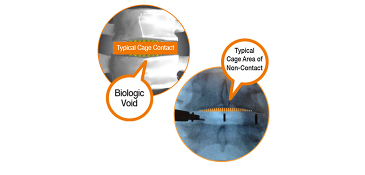 Pinnacle Awarded Patent for Better Void Fill