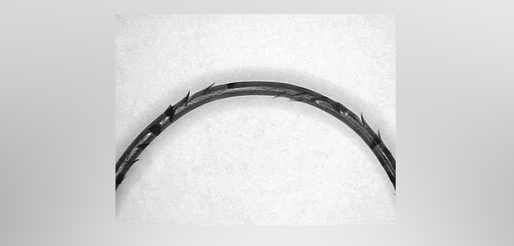 TKA Study: More Arthrotomy Failures With Barbed Sutures