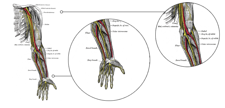 Surprising # of Median Nerve Harvest Mistakes; Outpatient vs Inpatient THA; Warfarin NO Barrier to Fast Fracture Repair?