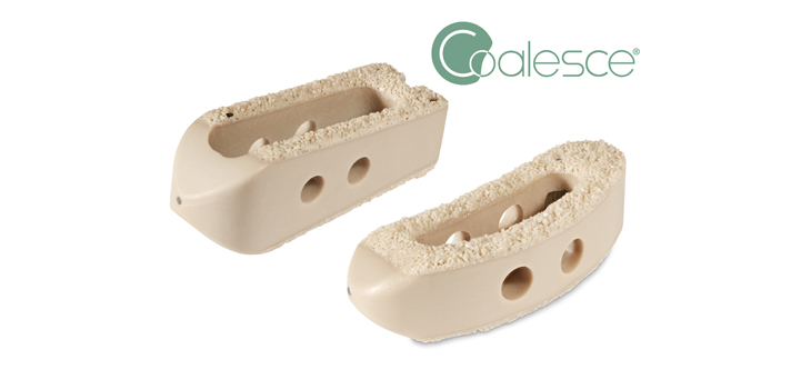 Vertera Spine Receives 510(k) Clearance for COALESCE