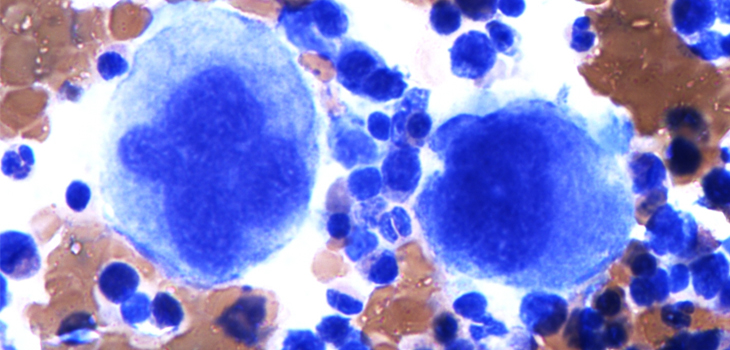 Ranfac Marrow Cellution Reaps a Better Harvest