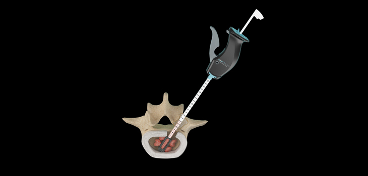New Graft Delivery Technology Receives Core Patent