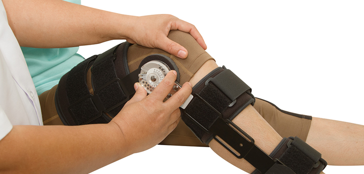 Orthopedics Braces Market Forecast to Hit $4.93 Billion