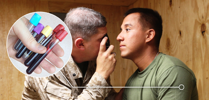 Blood Test May Improve Concussion Diagnosis